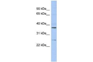 WB Suggested Anti-ZFAND6 Antibody Titration: 0. (ZFAND6 Antikörper  (Middle Region))