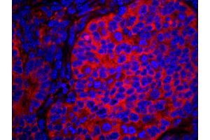 anti-eIF2 alpha/eif2s1 (C-Term) antibody