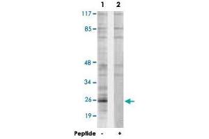 Western blot analysis of extracts from Jurkat cells, using PPP1R2 polyclonal antibody . (PPP1R2 Antikörper  (Ser120, Ser121))