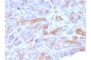 Immunohistochemistry (IHC) image for anti-ATP-Binding Cassette, Sub-Family C (CFTR/MRP), Member 3 (ABCC3) (AA 815-957) antibody (ABIN6940972)