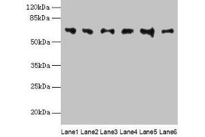 Western blot All lanes: FBXO24 antibody at 1 μg/mL Lane 1: Mouse gonadal tissue Lane 2: Mouse kidney tissue Lane 3: A549 whole cell lysate Lane 4: 293T whole cell lysate Lane 5: Jurkat whole cell lysate Lane 6: MCF-7 whole cell lysate Secondary Goat polyclonal to rabbit IgG at 1/10000 dilution Predicted band size: 65, 37, 70, 64 kDa Observed band size: 65 kDa (FBXO24 Antikörper  (AA 1-200))
