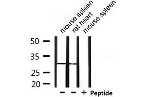Western blot analysis of extracts from mouse spleen and rat heart, using OTUB1 Antibody.