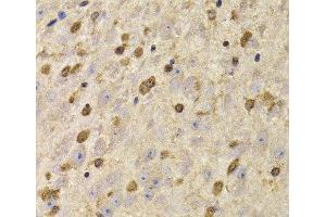 Immunohistochemistry of paraffin-embedded Mouse brain using QKI Polyclonal Antibody at dilution of 1:100 (40x lens). (QKI Antikörper)