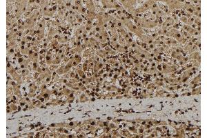 ABIN6279080 at 1/100 staining Human liver tissue by IHC-P. (ADAM33 Antikörper  (Internal Region))