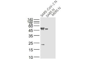 SARS-Coronavirus Nucleocapsid Protein (SARS-CoV N) Antikörper