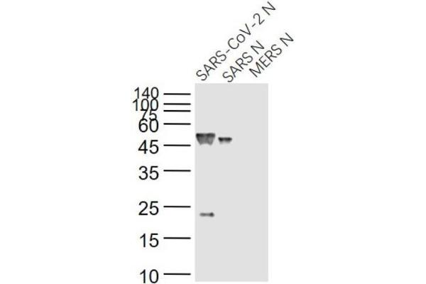 SARS-Coronavirus Nucleocapsid Protein (SARS-CoV N) Antikörper