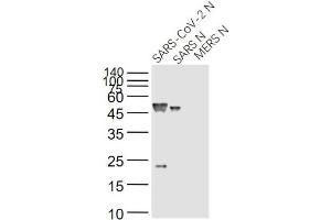 Lane 1: SARS-CoV-2 N Protein; Lane 2: Recombinant SARS N (1-422) protein; Lane 3: MERS N protein probed with SARS Nucleocapsid Protein (14B3D) Monoclonal Antibody, Unconjugated (bsm-49134M) at 1:1000 dilution and 4˚C overnight incubation. (SARS-Coronavirus Nucleocapsid Protein (SARS-CoV N) Antikörper)