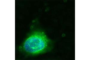 Image no. 3 for anti-CD36 (CD36) (Extracellular Domain) antibody (ABIN350201)