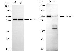 Western blotting analysis using ZNF598 antibody (ABIN7800898). (ZNF598 Antikörper)