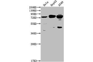 Western Blot Positive WB detected in: Hela whole cell lysate, HepG2 whole cell lysate, A549 whole cell lysate All lanes: HTR2C antibody at 1:2000 Secondary Goat polyclonal to rabbit IgG at 1/50000 dilution Predicted band size: 52, 29 kDa Observed band size: 75 kDa (Rekombinanter HTR2C Antikörper)