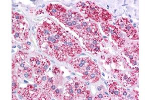 ABCB1 antibody was used for immunohistochemistry at a concentration of 4-8 ug/ml. (ABCB1 Antikörper)