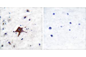 Peptide - +Immunohistochemical analysis of paraffin-embedded human brain tissue using GLUT3 antibody (#C0214). (SLC2A3 Antikörper)
