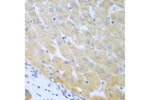 Immunohistochemistry of paraffin-embedded human liver using BECN1 antibody at dilution of 1:100 (40x lens).