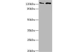 Western blot All lanes: KDM4B antibody at 4 μg/mL Lane 1: Jurkat whole cell lysate Lane 2: k562 whole cell lysate Secondary Goat polyclonal to rabbit IgG at 1/10000 dilution Predicted band size: 122, 51 kDa Observed band size: 122 kDa (KDM4B Antikörper  (AA 1-260))