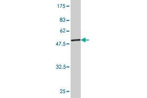 Western Blot detection against Immunogen (53. (TPI1 Antikörper  (AA 1-249))