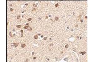 Immunohistochemistry of Stk39 in human brain tissue with this product at 2. (STK39 Antikörper  (Center))