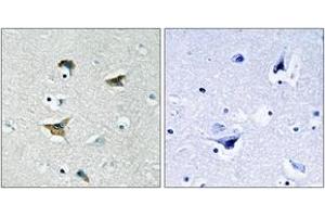 Immunohistochemistry analysis of paraffin-embedded human brain tissue, using FAK (Ab-397) Antibody. (FAK Antikörper  (AA 363-412))