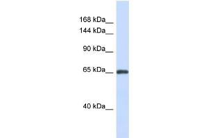 Host:  Rabbit  Target Name:  ZNF280D  Sample Type:  Fetal Brain lysates  Antibody Dilution:  1. (ZNF280D Antikörper  (N-Term))