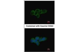 ICC/IF Image Immunofluorescence analysis of methanol-fixed A431, using LDHA, antibody at 1:500 dilution. (Lactate Dehydrogenase A Antikörper)