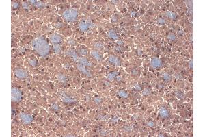 IHC analysis of GABA(A)R Beta 3 in frozen sections of mouse brain extract using GABRB3 antibody. (GABRB3 Antikörper  (AA 370-433))