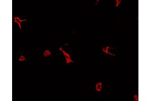 ABIN6276965 staining HepG2? (RAB27A Antikörper  (C-Term))