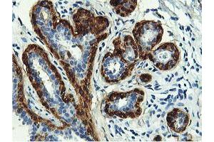 Immunohistochemical staining of paraffin-embedded Human breast tissue using anti-TAGLN mouse monoclonal antibody. (Transgelin Antikörper)