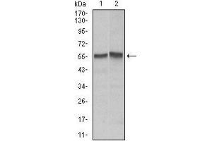 Western blot analysis using FAS mouse mAb against Hela (1), Jurkat (2) cell lysate. (FAS Antikörper)