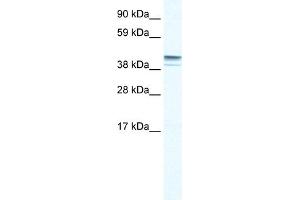 WB Suggested Anti-ZNF627 Antibody Titration:  0. (ZNF627 Antikörper  (N-Term))