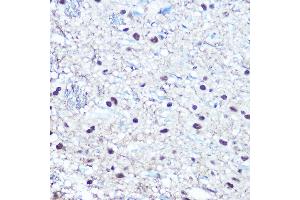 Immunohistochemistry of paraffin-embedded rat brain using Phospho-RB-S780 Rabbit pAb (ABIN3020471, ABIN3020472, ABIN3020473 and ABIN1681996) at dilution of 1:100 (40x lens). (Retinoblastoma 1 Antikörper  (pSer780))
