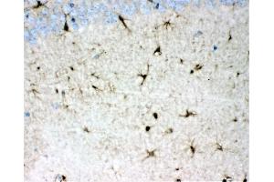 IHC analysis of DDAH1 using anti-DDAH1 antibody (ABIN4886560).