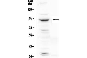 Western blot analysis of PLA2G6 using anti-PLA2G6 antibody . (PLA2G6 Antikörper  (AA 715-802))