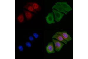 ABIN6256518 and ABIN6267413 staining Hela cells by IF/ICC. (CEBPB Antikörper  (pThr188, pThr235))