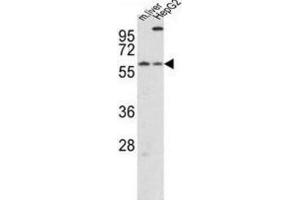 Western Blotting (WB) image for anti-Cryptochrome 2 (Photolyase-Like) (CRY2) antibody (ABIN3002520) (CRY2 Antikörper)