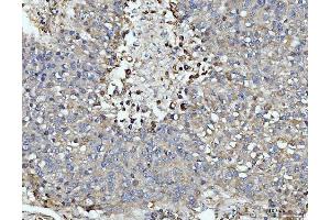 IHC analysis of DUSP6 using anti-DUSP6 antibody (ABIN7599332).