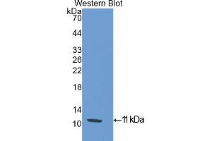 Western blot analysis of the recombinant protein. (SLIT3 Antikörper  (AA 454-498))