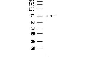 anti-Glucuronidase, beta (GUSB) (Internal Region) antibody