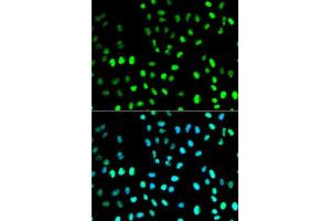 Immunofluorescence analysis of MCF7 cell using SUMO1 antibody. (SUMO1 Antikörper  (AA 1-101))