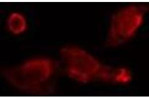 ABIN6275750 staining  Hela cells by IF/ICC. (BRE Antikörper  (C-Term))