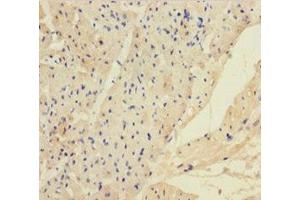 Immunohistochemistry of paraffin-embedded human heart tissue using ABIN7144104 at dilution of 1:100 (ANGPTL2 Antikörper  (AA 23-493))