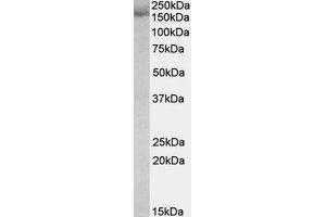 Western Blotting (WB) image for anti-Stromal Antigen 2 (STAG2) (Internal Region) antibody (ABIN2464858) (STAG2 Antikörper  (Internal Region))