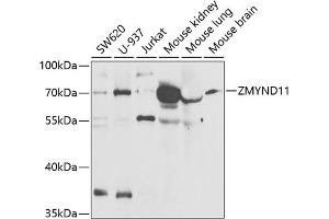 Western blot analysis of extracts of various cell lines, using ZMYND11 antibody (ABIN6133152, ABIN6150457, ABIN6150458 and ABIN6221937) at 1:1000 dilution. (ZMYND11 Antikörper  (AA 278-567))