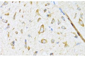 Immunohistochemistry of paraffin-embedded Mouse spinal cord using DNAJB11 Polyclonal Antibody at dilution of 1:100 (40x lens). (DNAJB11 Antikörper)