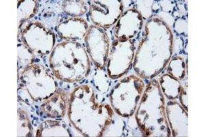Immunohistochemical staining of paraffin-embedded Kidney tissue using anti-LIPG mouse monoclonal antibody. (LIPG Antikörper)