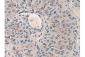 DAB staining on IHC-P; Samples: Mouse Ovary Tissue (HPS4 Antikörper  (AA 20-214))