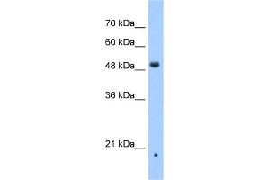 WB Suggested Anti-ZDHHC16 Antibody Titration:  0.
