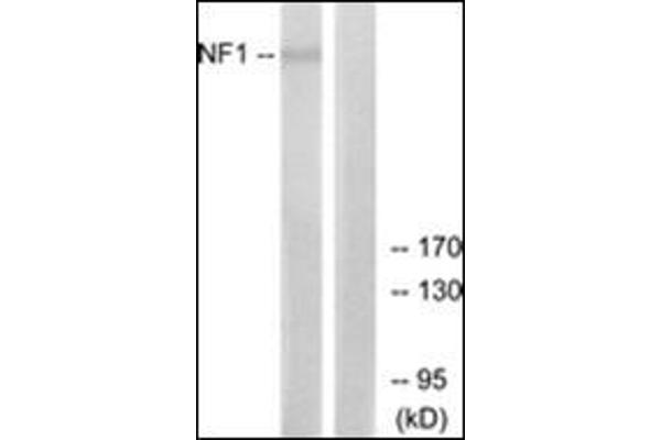 Neurofibromin 1 Antikörper  (Internal Region)