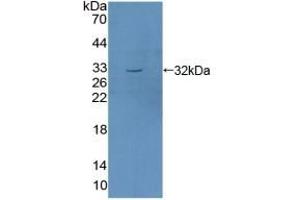 Detection of Recombinant SGK1, Mouse using Polyclonal Antibody to Serum/Glucocorticoid Regulated Kinase 1 (SGK1) (SGK1 Antikörper  (AA 145-386))