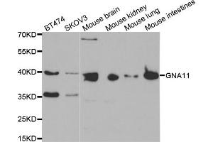Western blot analysis of extracts of various cell lines, using GNA11 antibody (ABIN5971457) at 1:400 dilution. (GNA11 Antikörper)