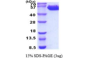 SDS-PAGE (SDS) image for Colony Stimulating Factor 2 Receptor, Beta (CSF2RB) (AA 17-443) protein (His tag) (ABIN5854442) (CD131 Protein (AA 17-443) (His tag))