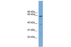 WB Suggested Anti-PSMD3 Antibody Titration: 0. (PSMD3 Antikörper  (Middle Region))